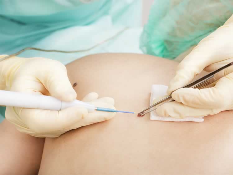 Dermatologia Cirúrgica